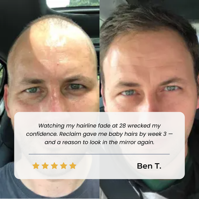 Reclaim Hairline Recovery Serum