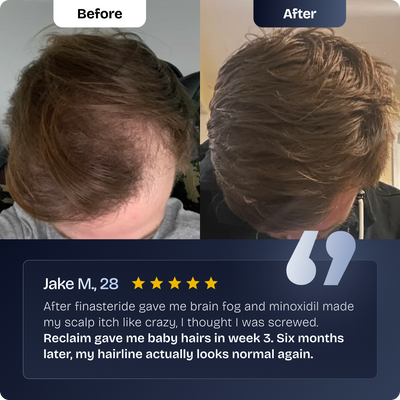 Reclaim Hairline Recovery Serum
