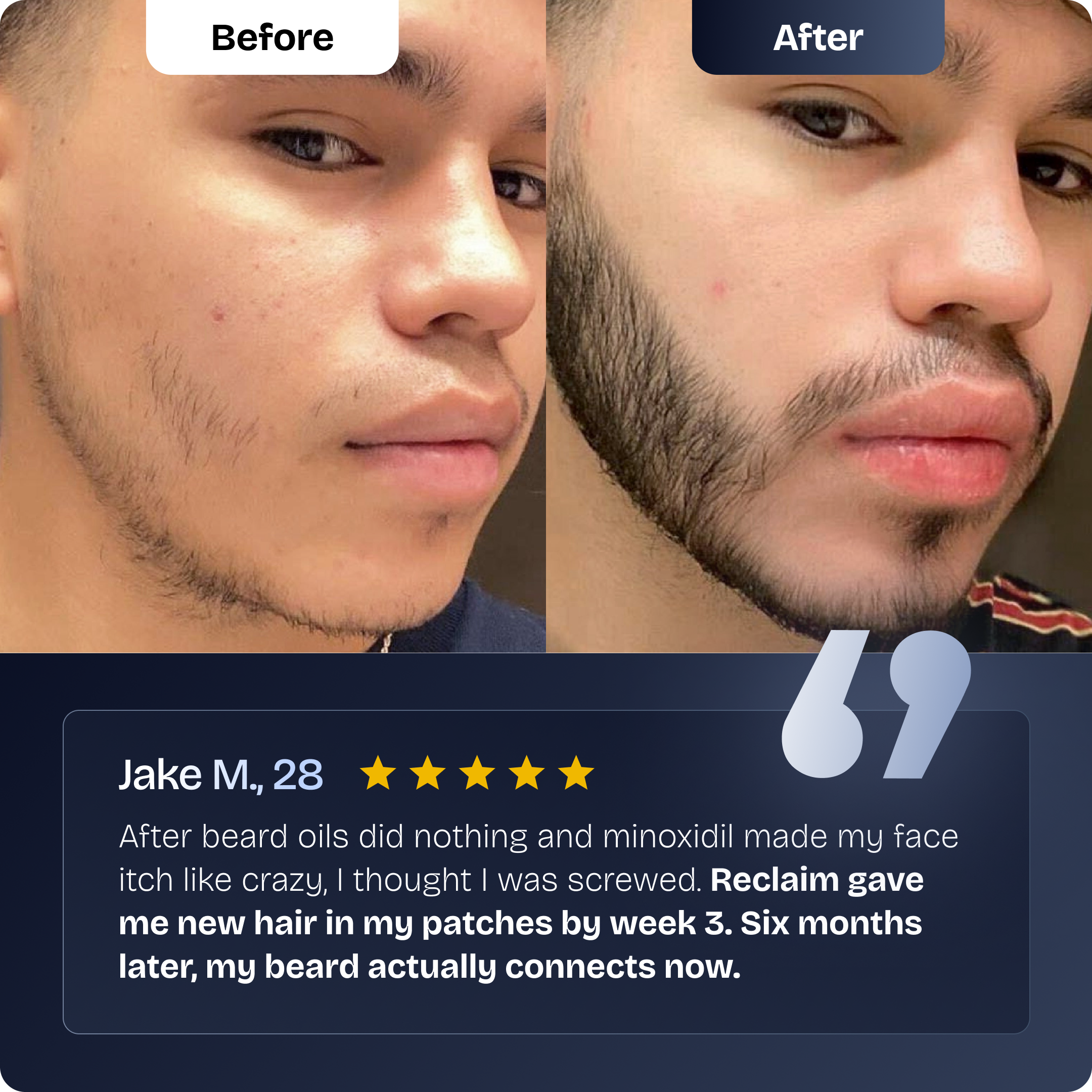 Reclaim Beard Growth Serum