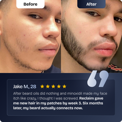 Reclaim Beard Growth Serum