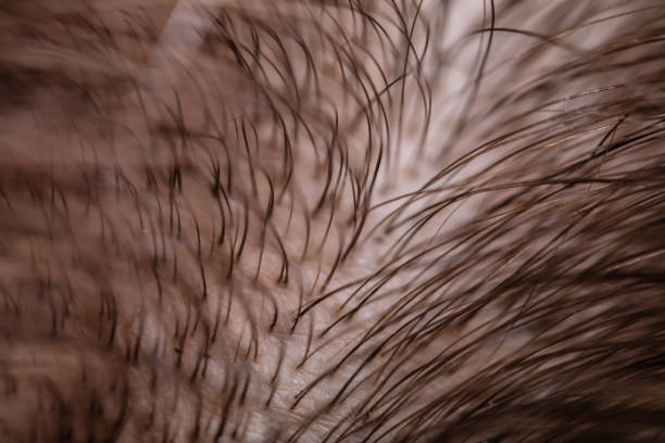 Kickstart Your Hair at the Root