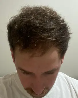 Matt D