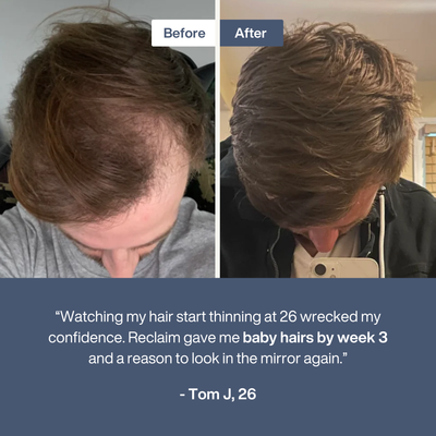 Reclaim Hairline Recovery Serum